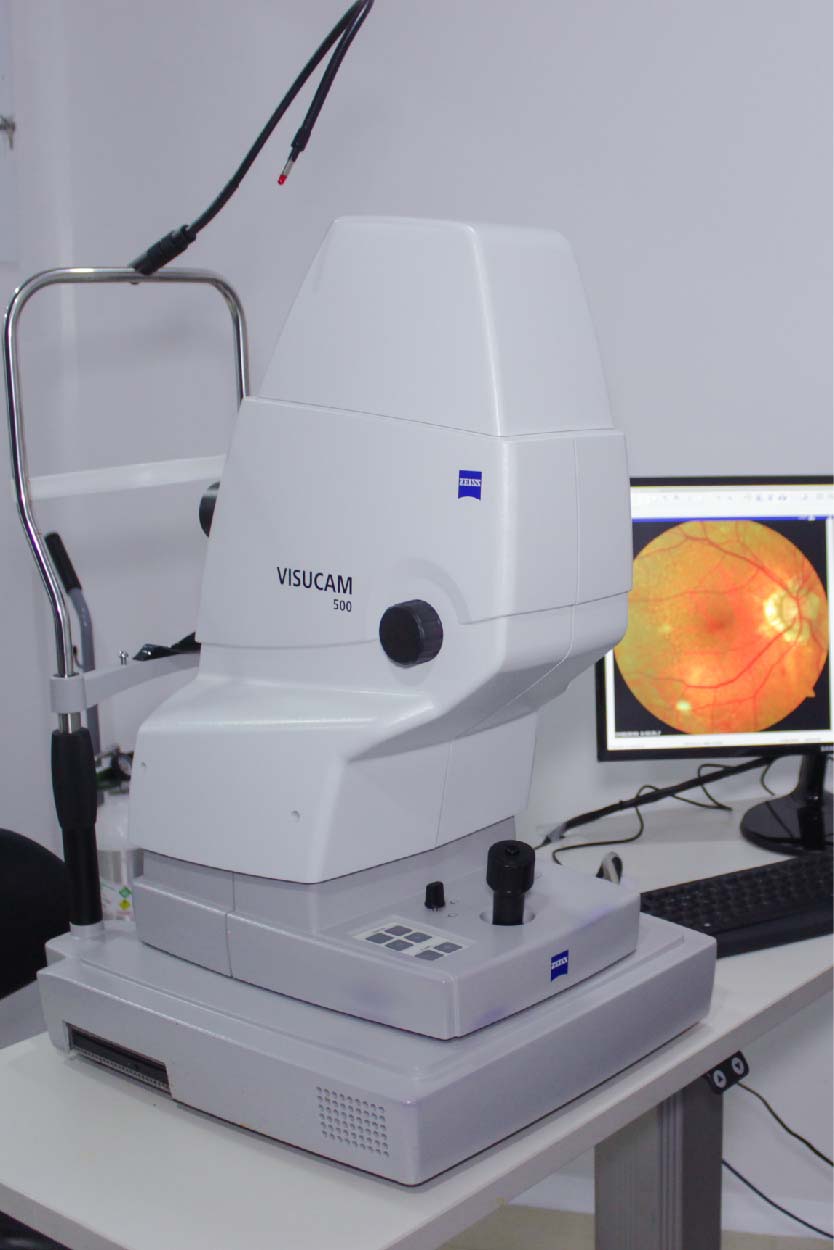 angiografo